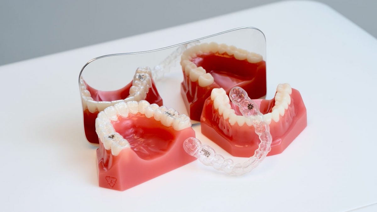 Invisalign München Zahnarzt