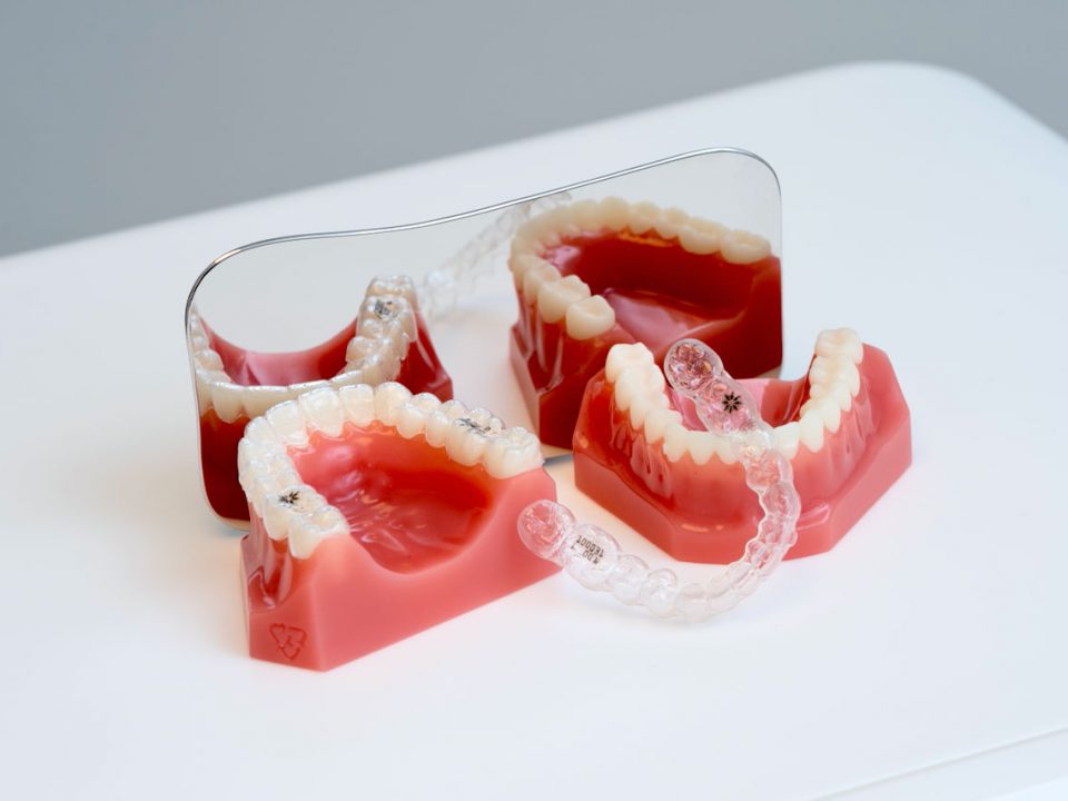 Invisalign München Zahnarzt