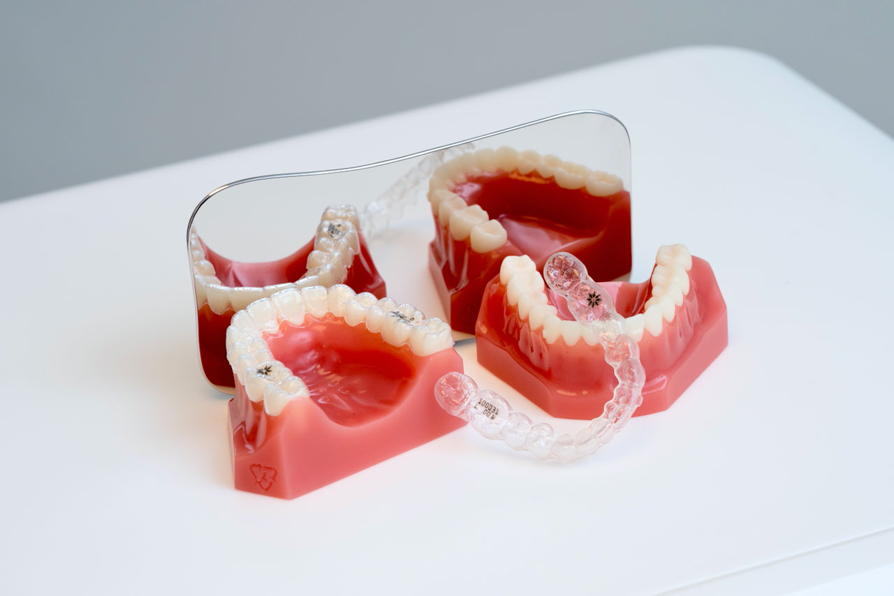 Invisalign München Zahnarzt